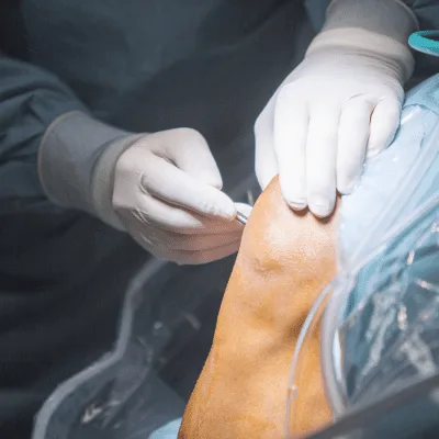 Especialista en el tratamiento de bursitis en Saltillo