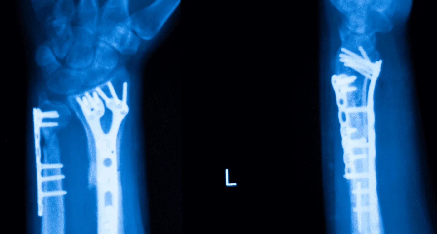 ¿Qué especialista trata el dolor articular?