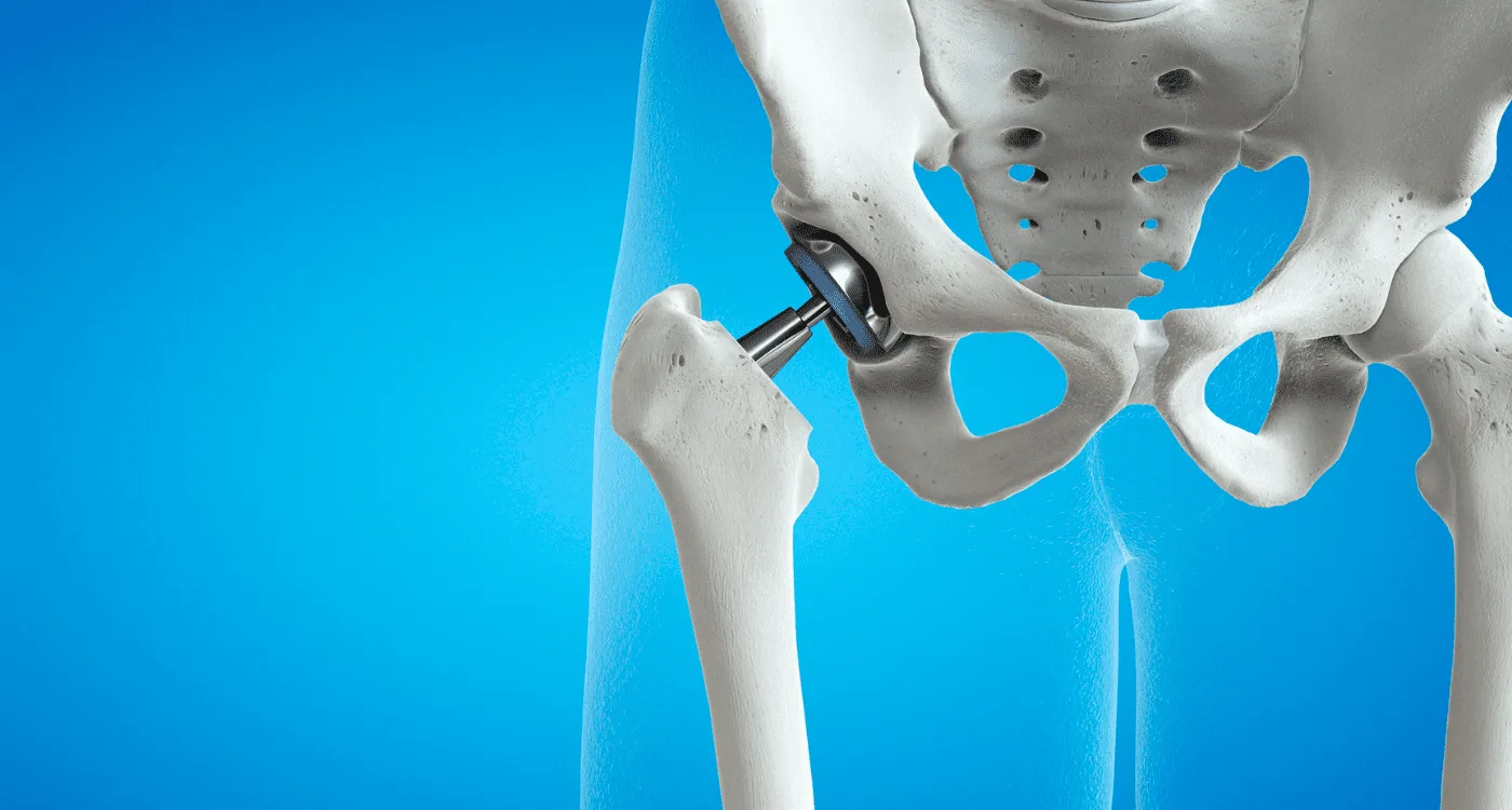 ¿Qué especialista trata las lesiones de columna?